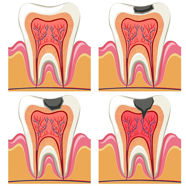 Endodoncia Clínica Dental Manuel Rodríguez