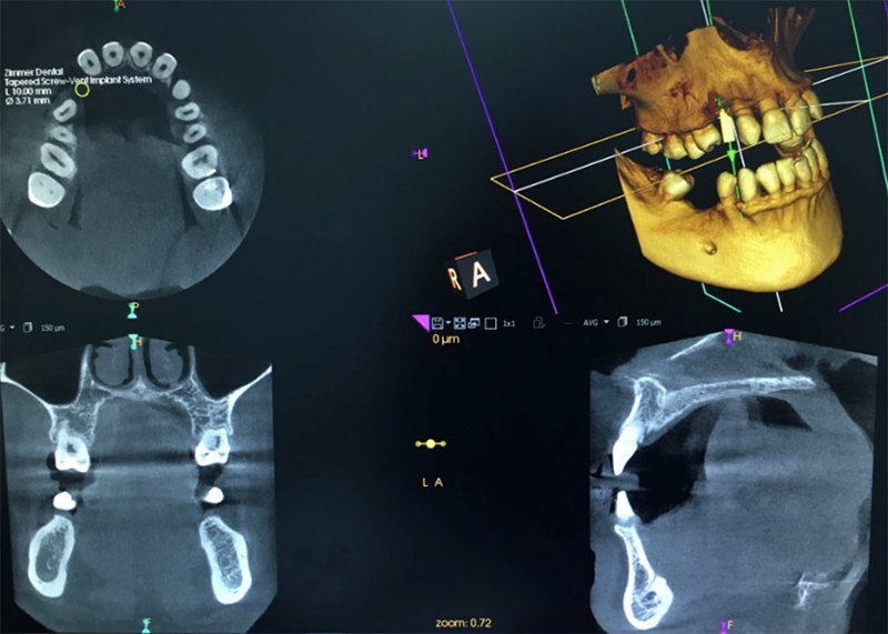 Radiología digital 3D para diagnosis dientes